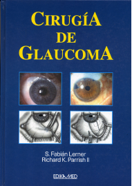cirugía de glaucoma