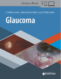 libro glaucoma