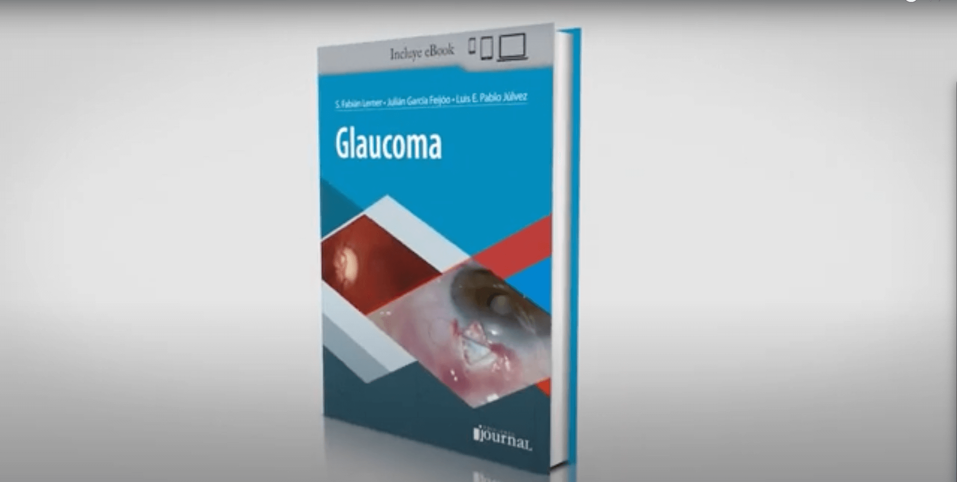 Presentación del libro Glaucoma